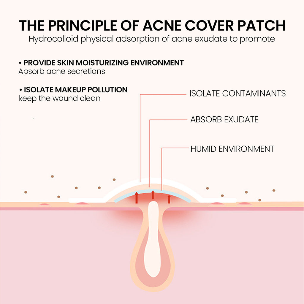 792PCS Hydrocolloid Acne Pimple Patches – Invisible Blemish Cover