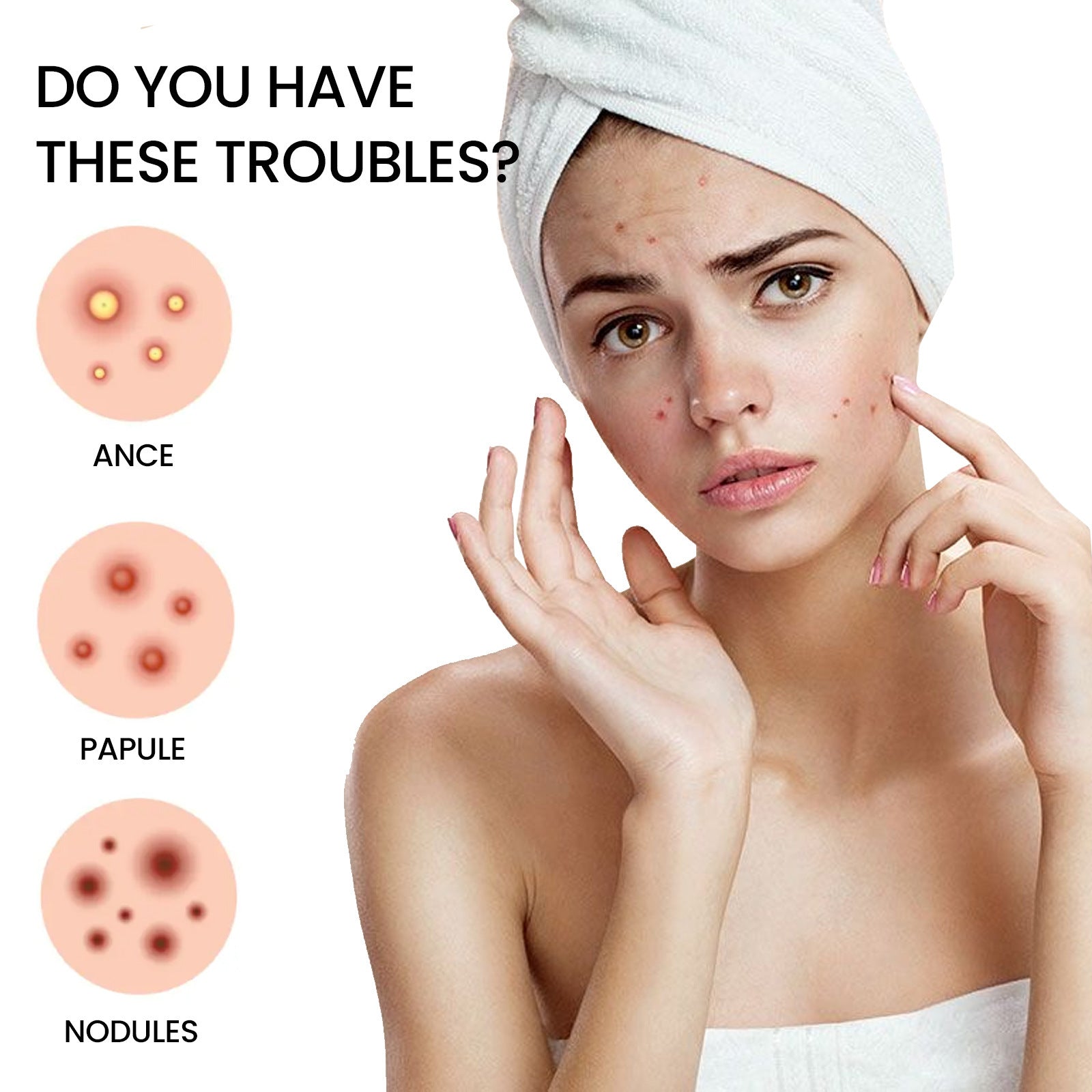 792PCS Hydrocolloid Acne Pimple Patches – Invisible Blemish Cover