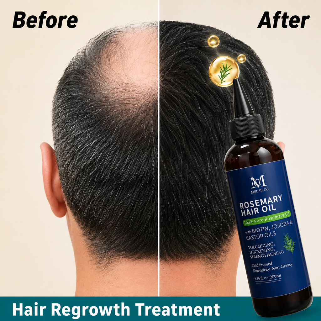 RoseRevive™ Organic Rosemary Hair Oil – Plant-Based Scalp & Hair Nourishing Treatment for Stronger, Fuller-Looking Hair (200ml)